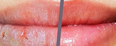 Lip Care