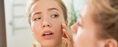 Sensitive Skin